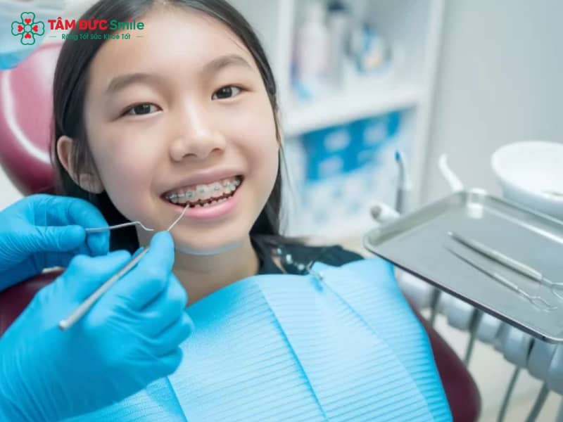 Niềng răng cho trẻ em: Độ tuổi lý tưởng, phương pháp và chi phí phù hợp từng bé
