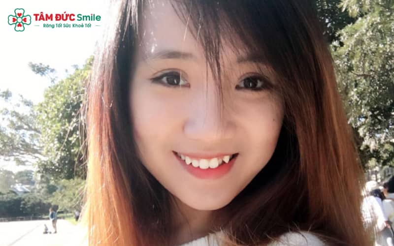 Nhân tướng học cho rằng răng nanh là biểu hiện của sự cứng cỏi, tự tin và quyết đoán