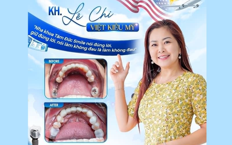 Phục hình răng mất tại Tâm Đức Smile mang lại kết quả thẩm mỹ và chức năng tối ưu