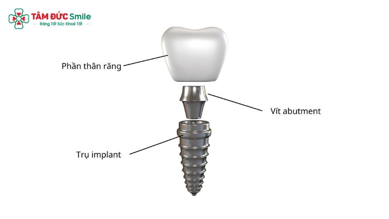 tru-titanium-2