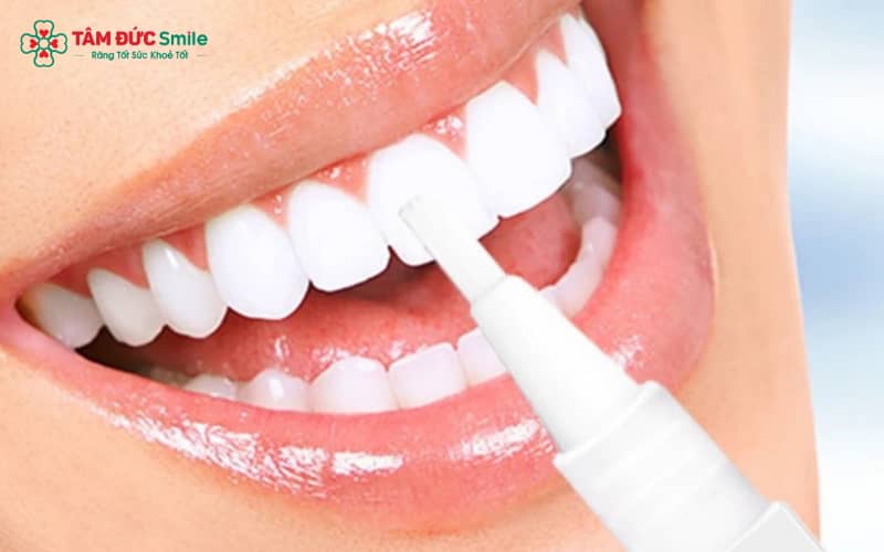 Bút tẩy trắng răng giúp loại bỏ ố vàng, mang lại răng trắng sáng
