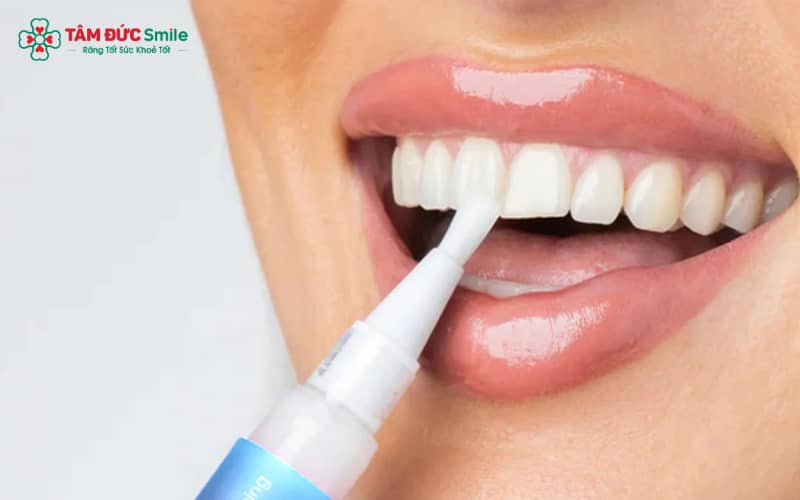 Bút tẩy trắng mang lại hiệu quả vượt trội, giúp răng trắng hơn từ 3 đến 4 tông sau 1 tuần