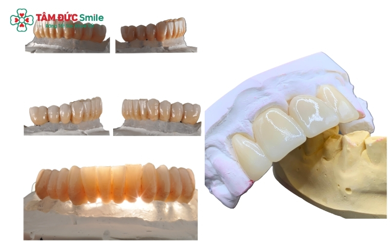 Hệ thống 5 dòng Katana Zirconia: Đa dạng lựa chọn về độ trong và khả năng chịu lực.