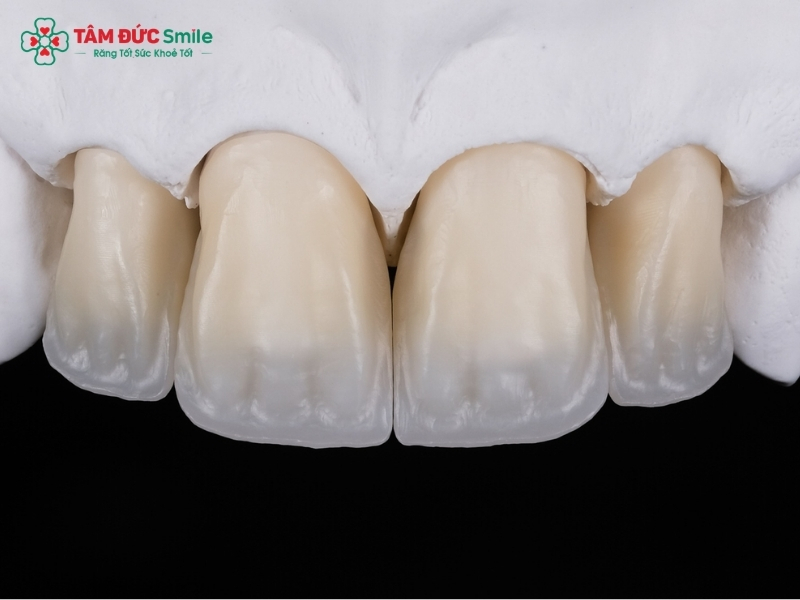 Răng sứ Katana có mấy loại? Phân biệt 5 dòng Katana Zirconia phổ biến nhất