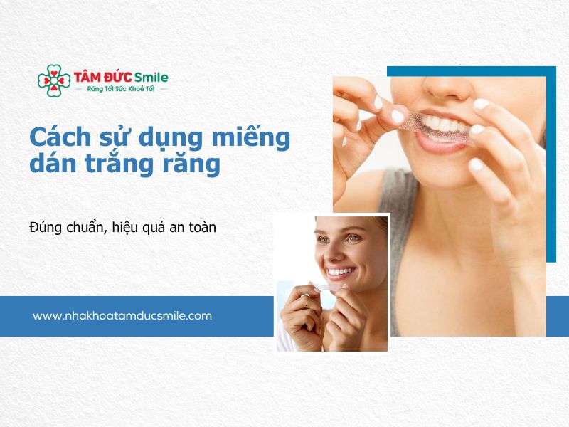 cach-su-dung-mieng-dan-trang-rang-dung-chuan-hieu-qua-an-toan-5