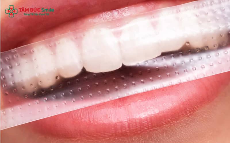 Để miếng dán trắng răng phát huy hiệu quả, bạn cần chải răng sạch, lau khô bề mặt, sau đó gỡ miếng dán và áp trực tiếp lên răng