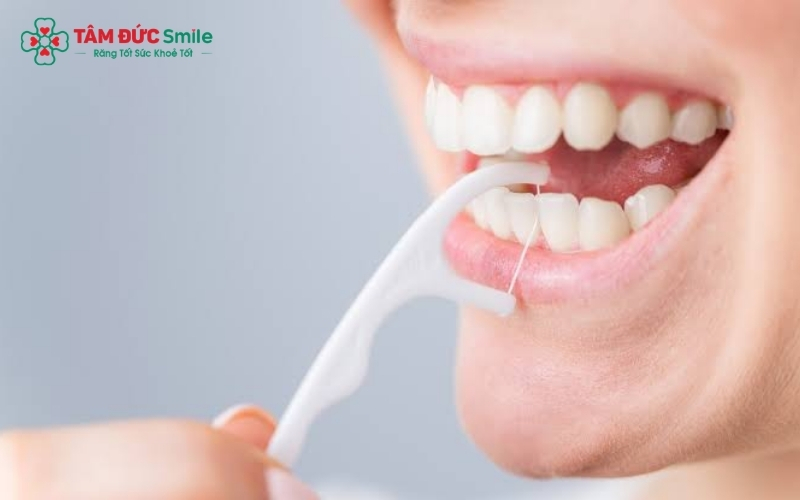 Thao tác "chữ C" giúp sợi chỉ ôm trọn mặt răng, loại bỏ mảng bám hiệu quả mà không làm tổn thương nướu.