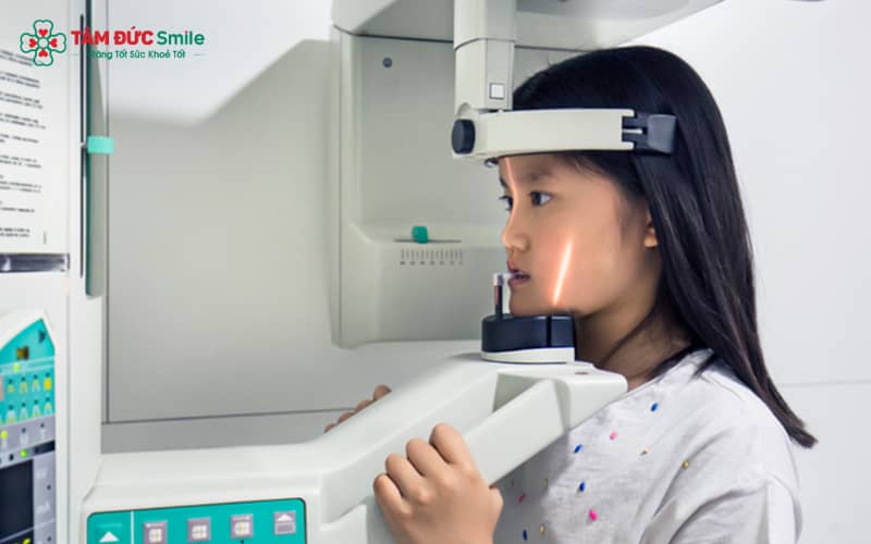 CT Cone Beam (3D) ứng dụng tia X hình nón để cung cấp hình ảnh ba chiều rõ nét về cấu trúc răng