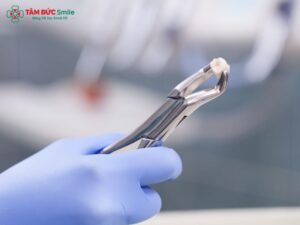 Bác sĩ thường chỉ định nhổ răng khôn mọc lệch, mọc ngầm hoặc gây viêm nhiễm để ngăn ngừa biến chứng răng miệng.