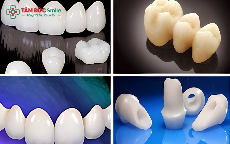 Đa dạng lựa chọn răng toàn sứ với độ bền và thẩm mỹ cao, phù hợp với nhu cầu và ngân sách của từng khách hàng