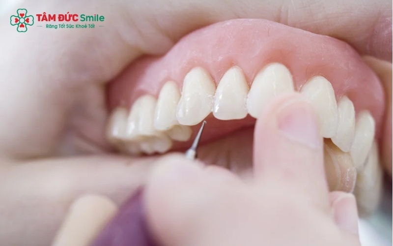 Phục hình răng sứ giúp khôi phục nụ cười rạng rỡ và chức năng ăn nhai như răng thật