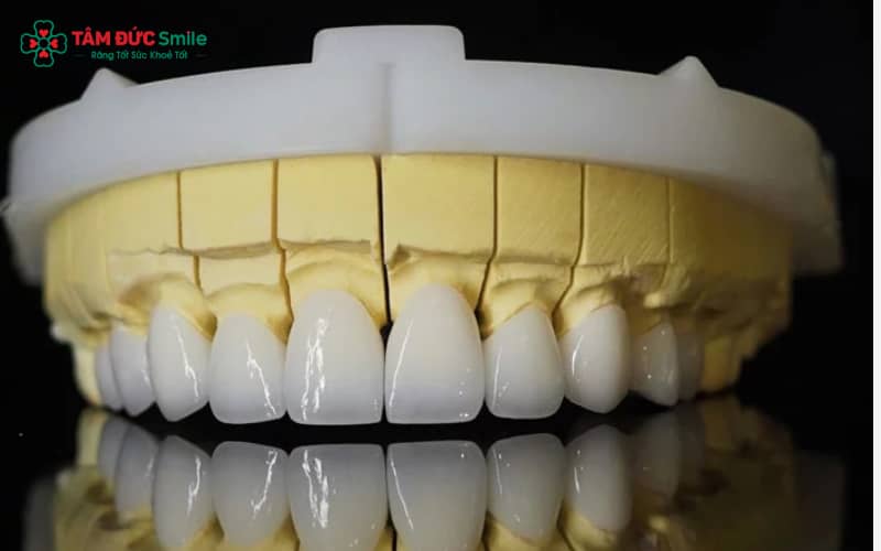 Răng sứ Lava Plus của tập đoàn 3M (Mỹ) mang đến chất lượng toàn sứ cao cấp, bền đẹp vượt trội