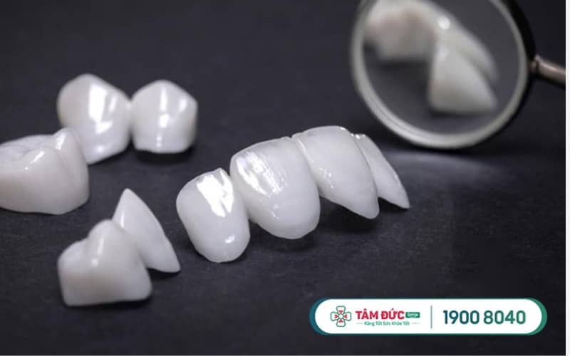 Răng sứ Lava Plus (Lava 3M) là lựa chọn toàn sứ cao cấp, được phát triển dựa trên nghiên cứu và công nghệ tiên tiến