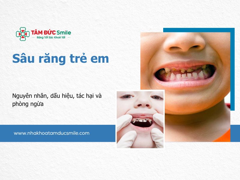 sau-rang-tre-em-5