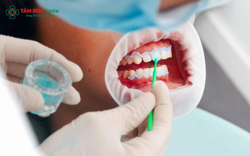 Bột tẩy trắng răng được chế tạo dưới dạng hạt mịn nhằm hỗ trợ cải thiện màu sắc răng
