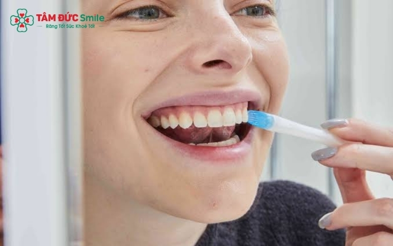 Thuốc tẩy trắng thiết kế riêng tại nha khoa giúp hạn chế tối đa việc thuốc tràn ra nướu gây kích ứng.