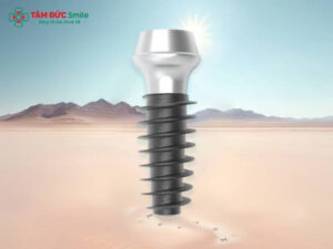 Các loại trụ Implant Hàn Quốc được sử dụng nhiều nhất