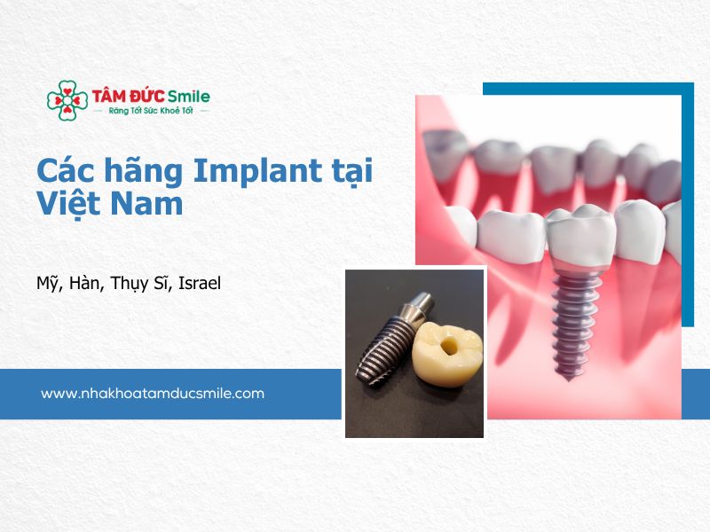 cac-hang-implant-tai-viet-nam-5