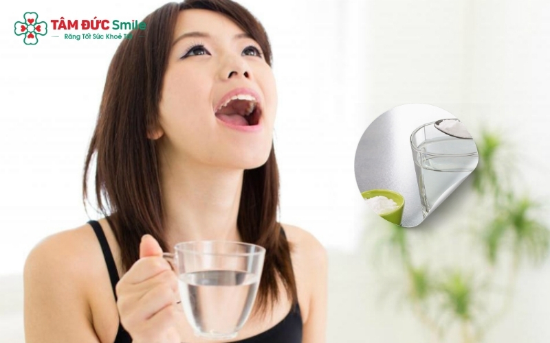 Súc miệng nước muối ấm là những biện pháp hỗ trợ giúp giảm sưng, kháng viêm và làm dịu cơn đau răng khôn hiệu quả tại nhà.