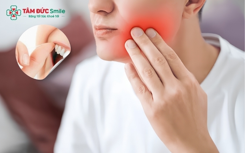Sử dụng chỉ nha khoa để loại bỏ mảng bám thức ăn và súc miệng bằng nước muối sinh lý là những bước cơ bản giúp làm sạch khoang miệng, giảm kích ứng tạm thời.