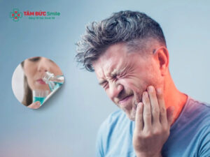 Cách giảm đau răng nhanh, hiệu quả tại nhà