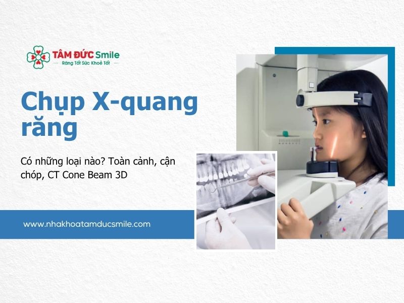 chup-x-quang-rang
