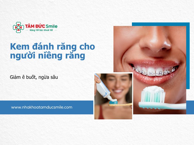 kem-danh-rang-cho-nguoi-nieng-rang-5