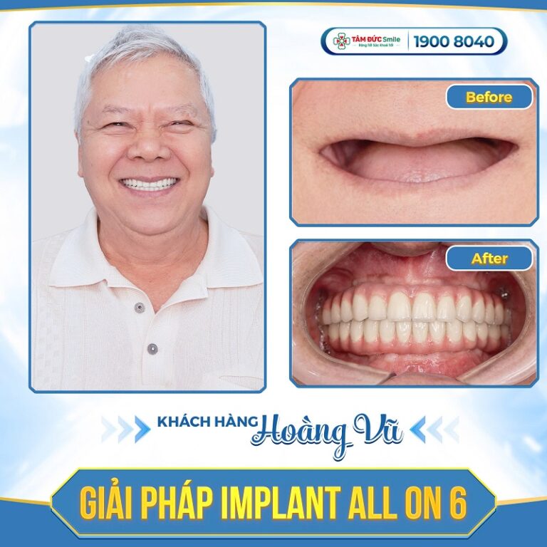 khach-hang-hoang-vu