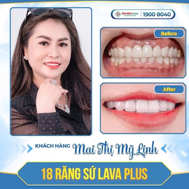 khach-hang-my-linh
