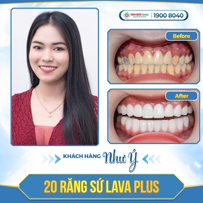 khach-hang-nhu-y
