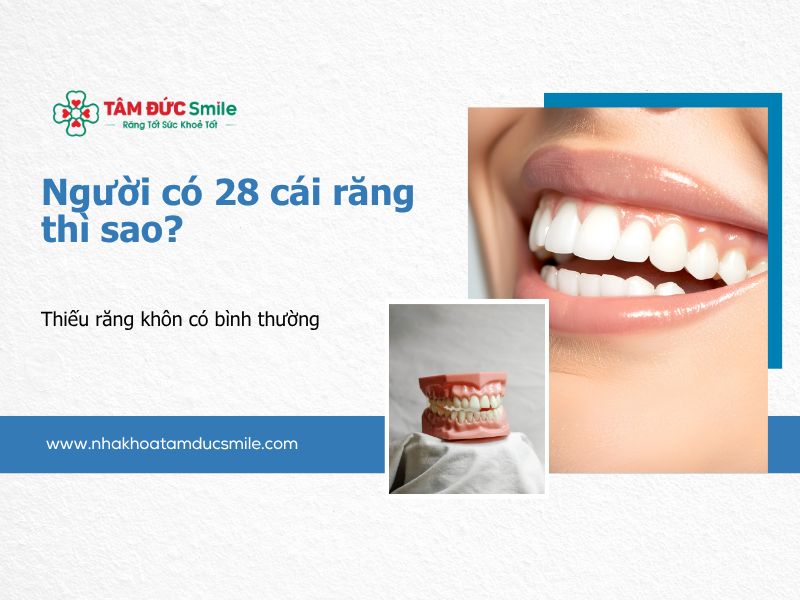 nguoi-co-28-cai-rang-thi-sao-5