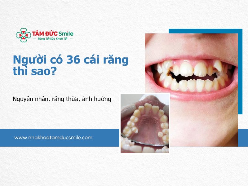 nguoi-co-36-cai-rang-thi-sao-5