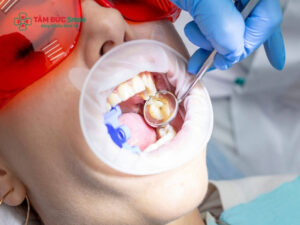 Nhổ răng khôn có đau không?
