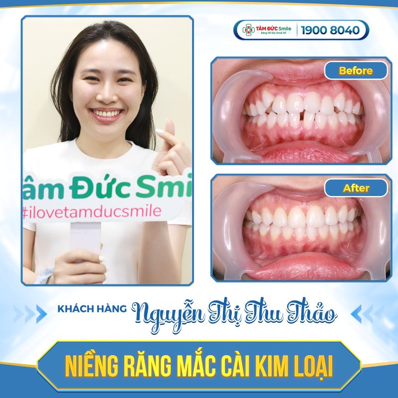 nieng-rang-2