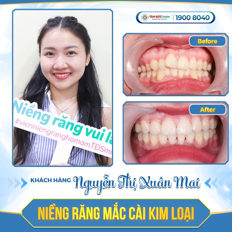 nieng-rang-3