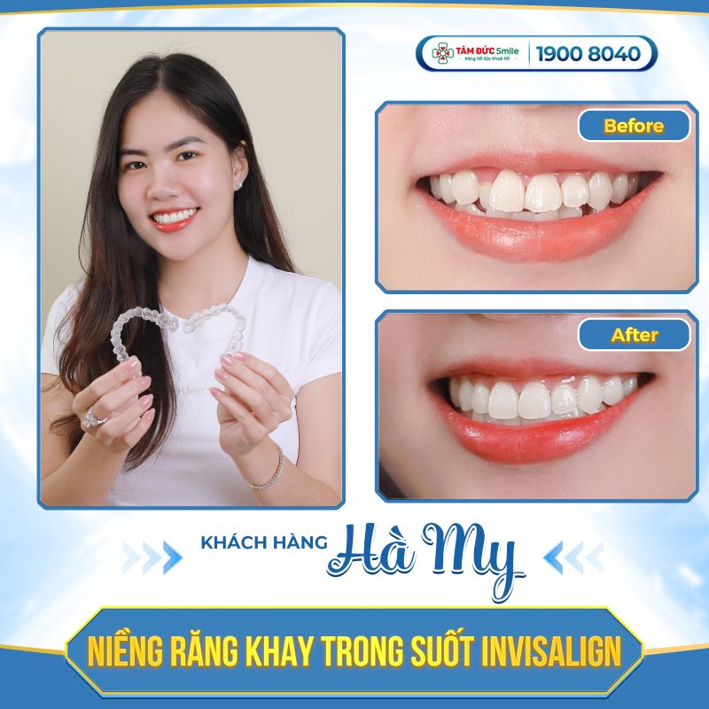 nieng-rang-4