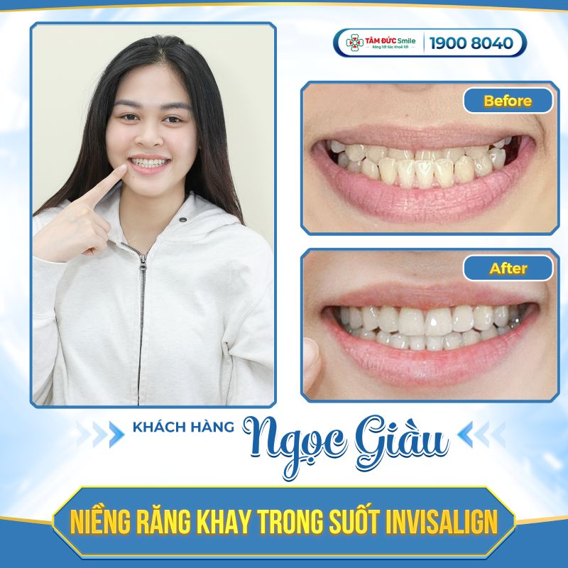 nieng-rang-5