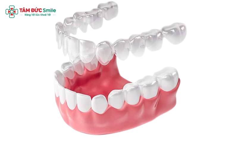 Thông qua sự hợp tác với ngân hàng, nhiều nha khoa hỗ trợ khách hàng trả góp linh hoạt với lãi suất 0%