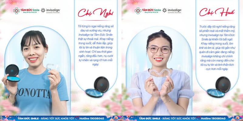 Niềng răng nhựa được ưa chuộng nhờ tính thẩm mỹ, cùng sự linh hoạt trong tháo lắp