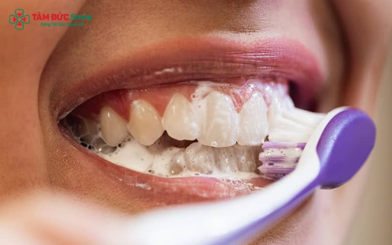 Vệ sinh răng sâu nhẹ cần thực hiện nhẹ tay, dùng bàn chải mềm và kem đánh răng fluoride