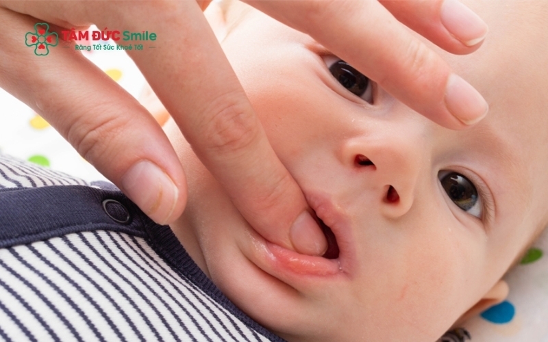 Sử dụng khăn mềm sạch, mát để massage nhẹ nhàng lên vùng nướu giúp giảm cảm giác đau và khó chịu cho bé trong giai đoạn mọc răng.