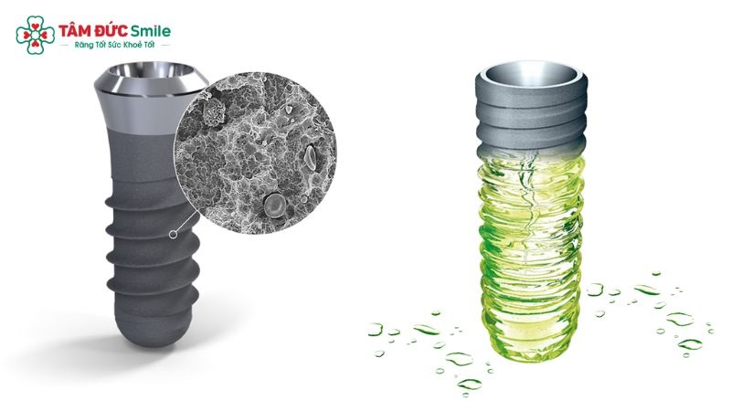 Implant Straumann SLA và SLActive ứng dụng công nghệ xử lý bề mặt giúp tăng tiếp xúc với mô xương, hỗ trợ quá trình tích hợp xương sau cấy ghép.