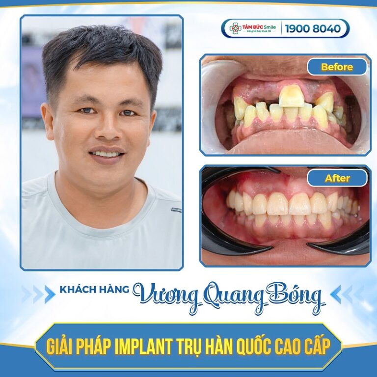 vuong-quang-bong