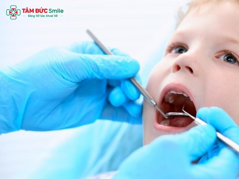Cách trị sâu răng cho trẻ tại nhà an toàn hiệu quả