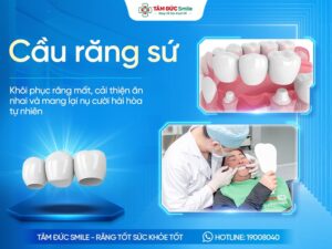 Cầu răng sứ là gì? Ưu nhược điểm, quy trình và chi phí