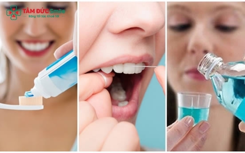 Vệ sinh răng miệng đúng cách với chỉ nha khoa và máy tăm nước là "chìa khóa" để mặt dán sứ duy trì độ bền lên đến 20 năm