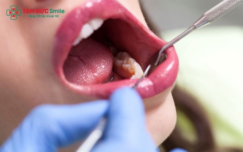 Tuân thủ hướng dẫn của bác sĩ thực hiện vệ sinh đúng cách là yếu tố quan trọng giúp vết thương nhanh ổn định và giảm sưng sau tiểu phẫu.