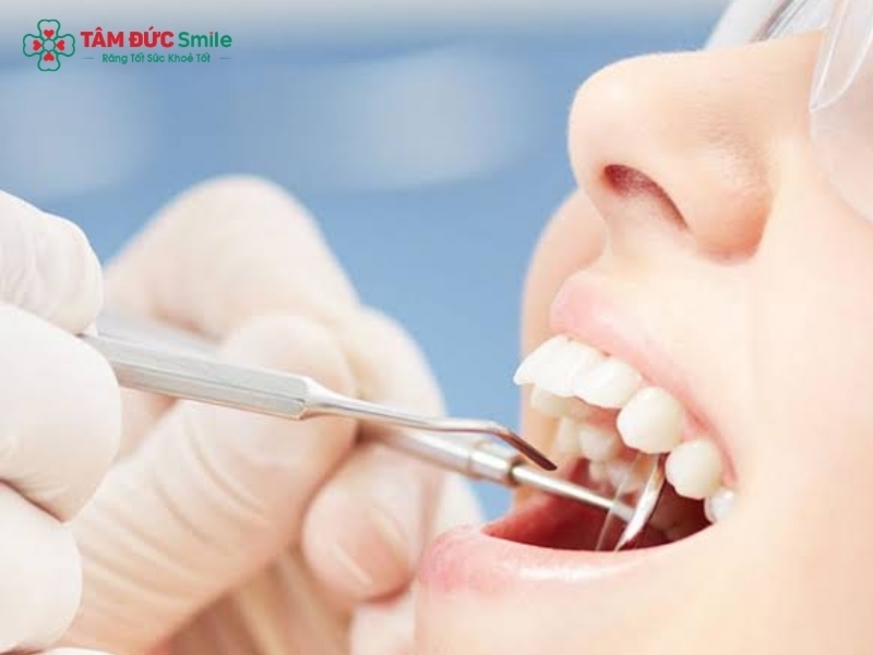 Quy trình nhổ răng khôn an toàn, ít đau tại Nha khoa