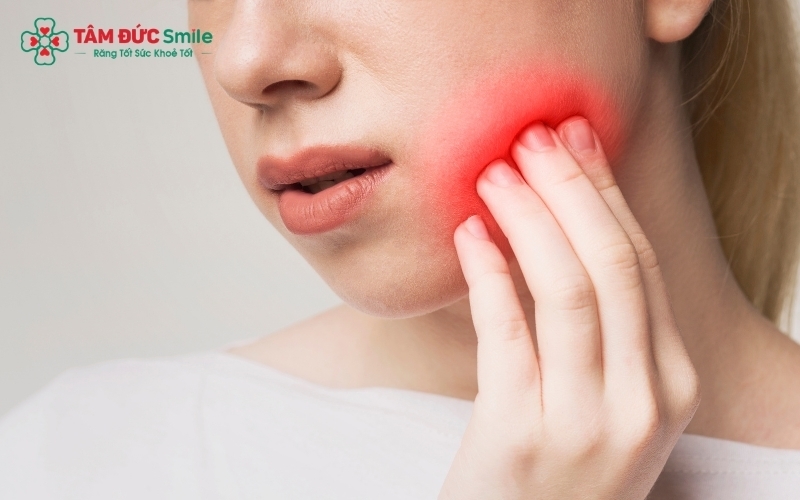 Nếu không điều trị sớm, sưng lợi răng khôn có thể dẫn đến áp xe, nhiễm trùng lan rộng và làm tổn thương nghiêm trọng