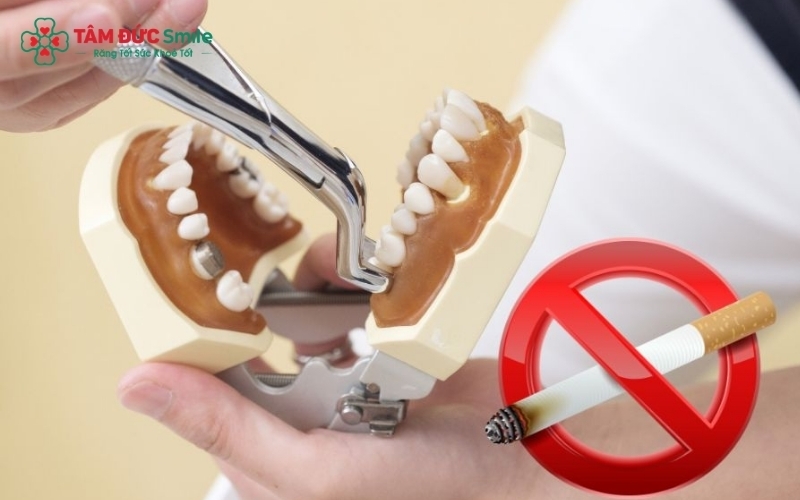 Tuyệt đối không dùng ống hút, không hút thuốc lá và tránh các thực phẩm quá dai, cứng để bảo vệ cục máu đông - yếu tố quan trọng nhất cho quá trình lành thương.